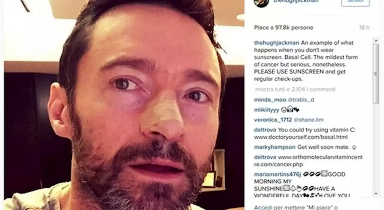 Hugh Jackman, testimonial contro i tumori della pelle