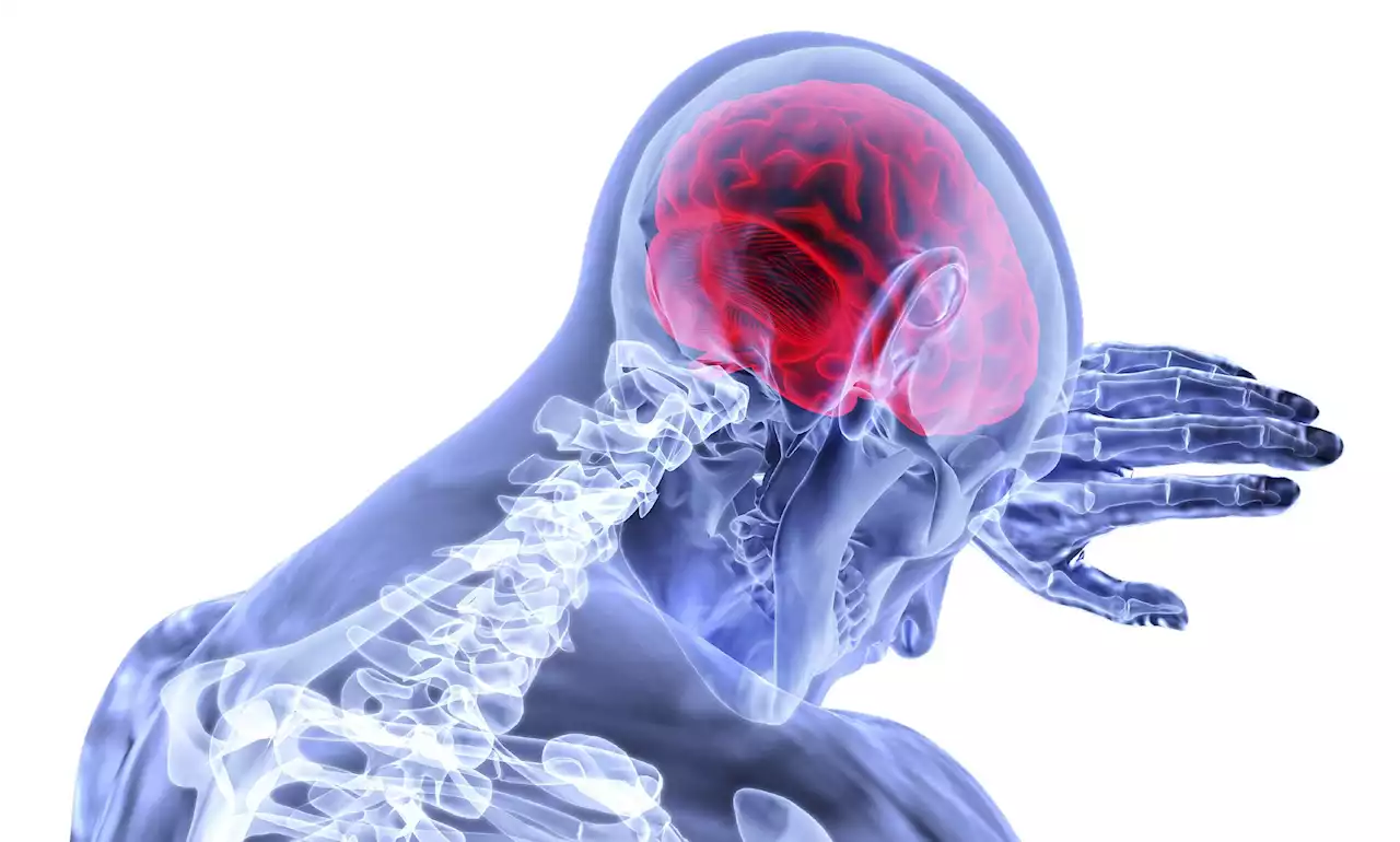 Experts discuss improving enrollment in acute stroke trials