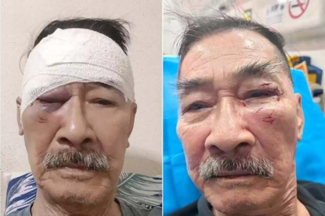 Security officer, 80, assaulted by man he spotted sleeping on public bench