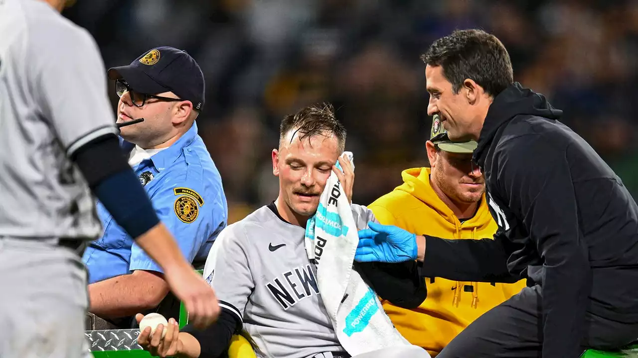 Yankees pitcher bloodied, carted off after taking 100 mph line drive off head