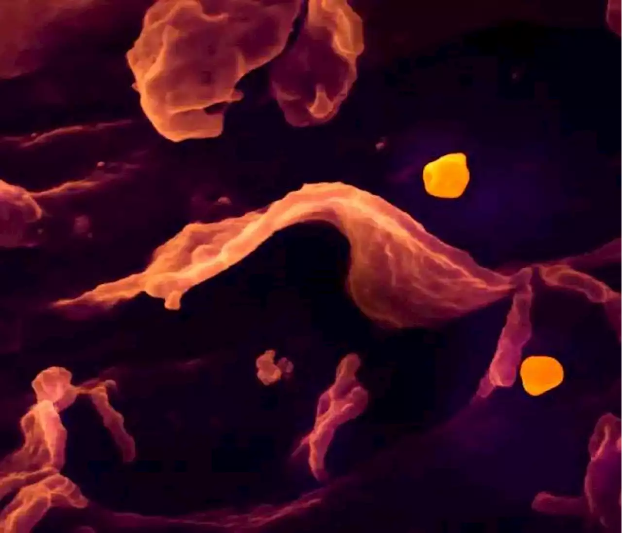 ¿Puede el brote del virus Nipah causar una nueva pandemia?