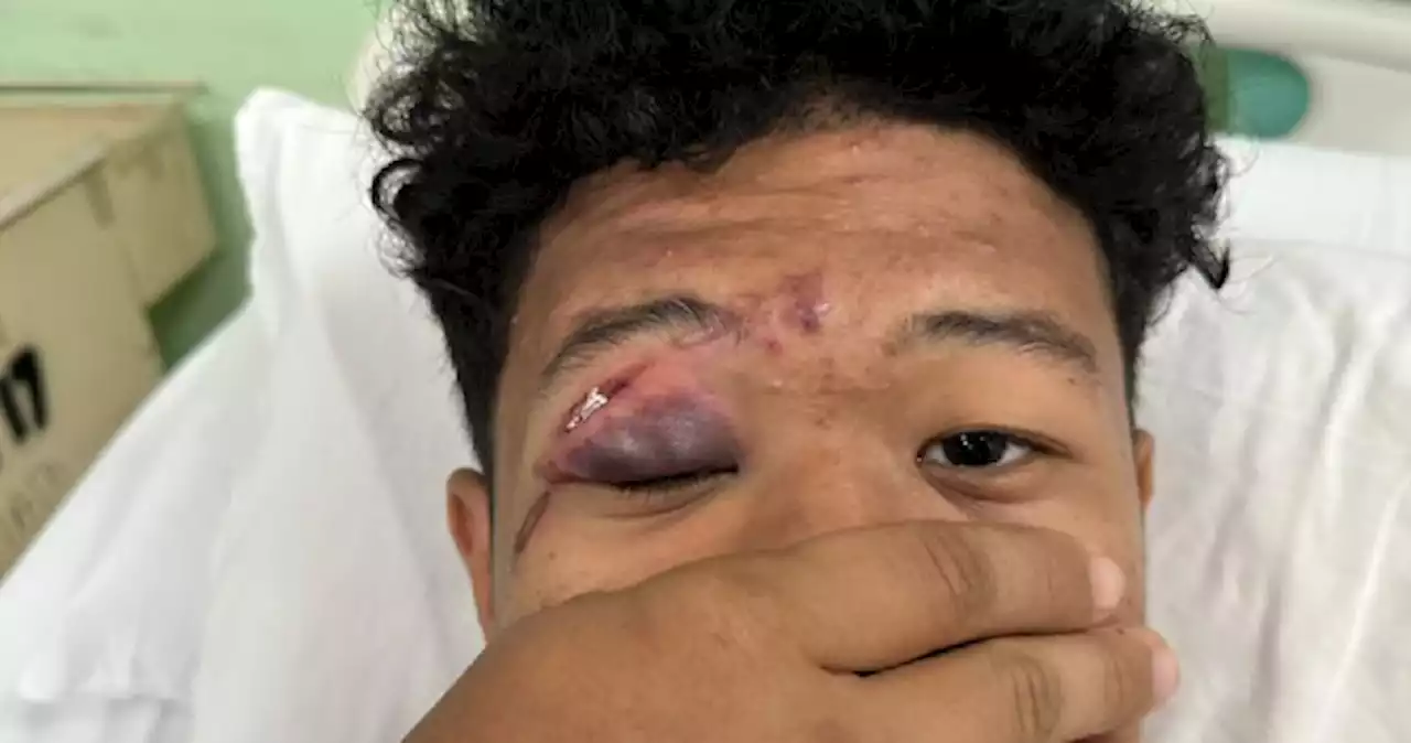 We're lucky he didn't go blind, says dad of Malaysian teen who was hit in the eye during school caning