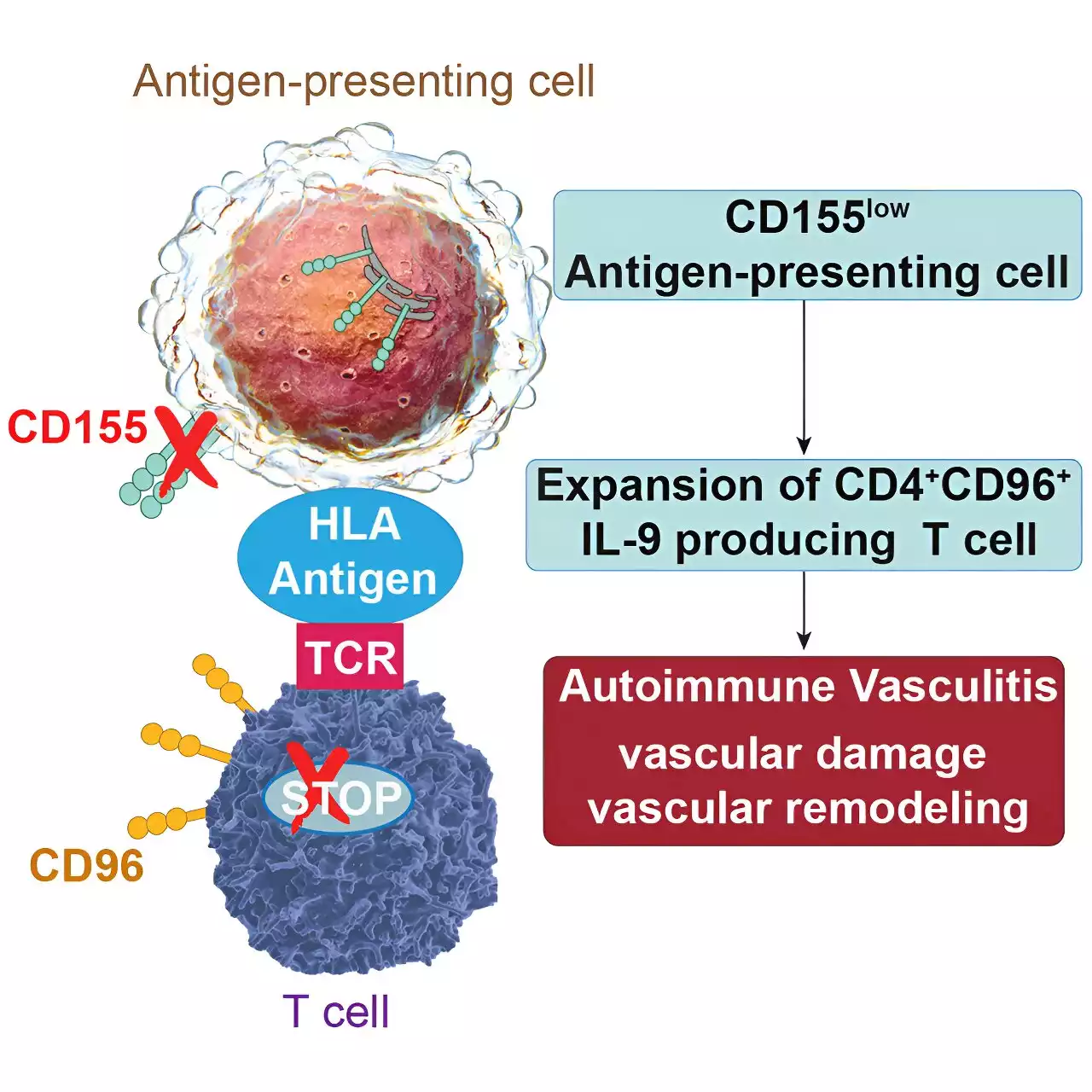 New insights into mysterious blood vessel disease temporal arteritis