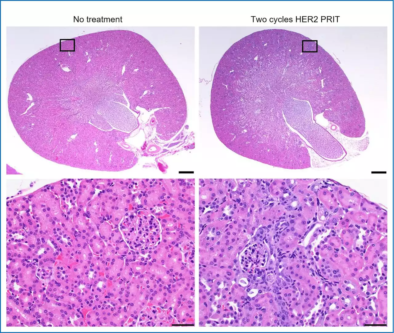 Nuclear medicine treatment cures lethal form of ovarian cancer in preclinical setting