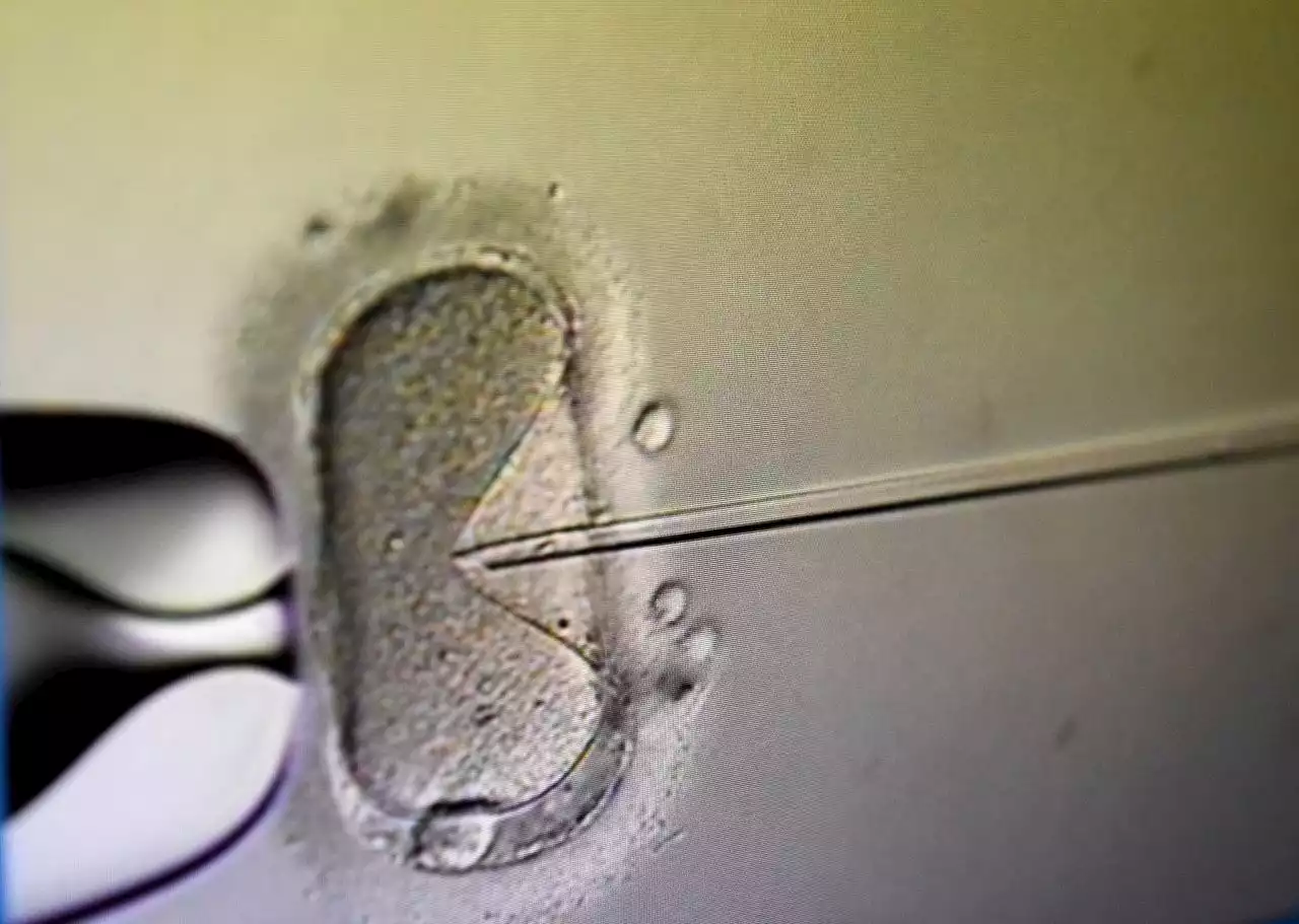 Case before Alabama Supreme Court could shut down fertility clinics, medical group warns