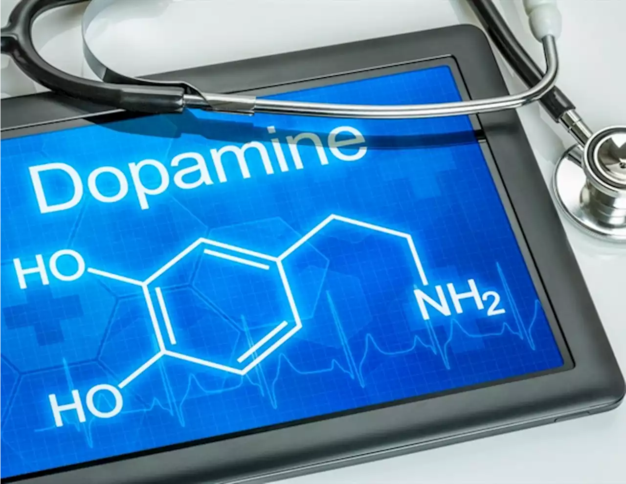 Researchers identify new blood marker for dopamine system damage