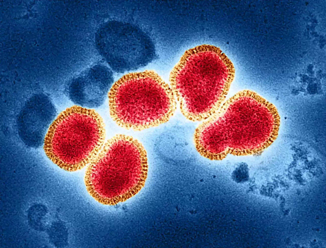 A Shot at Universality: NIH Kicks Off Clinical Trials for the Ultimate Flu Vaccine