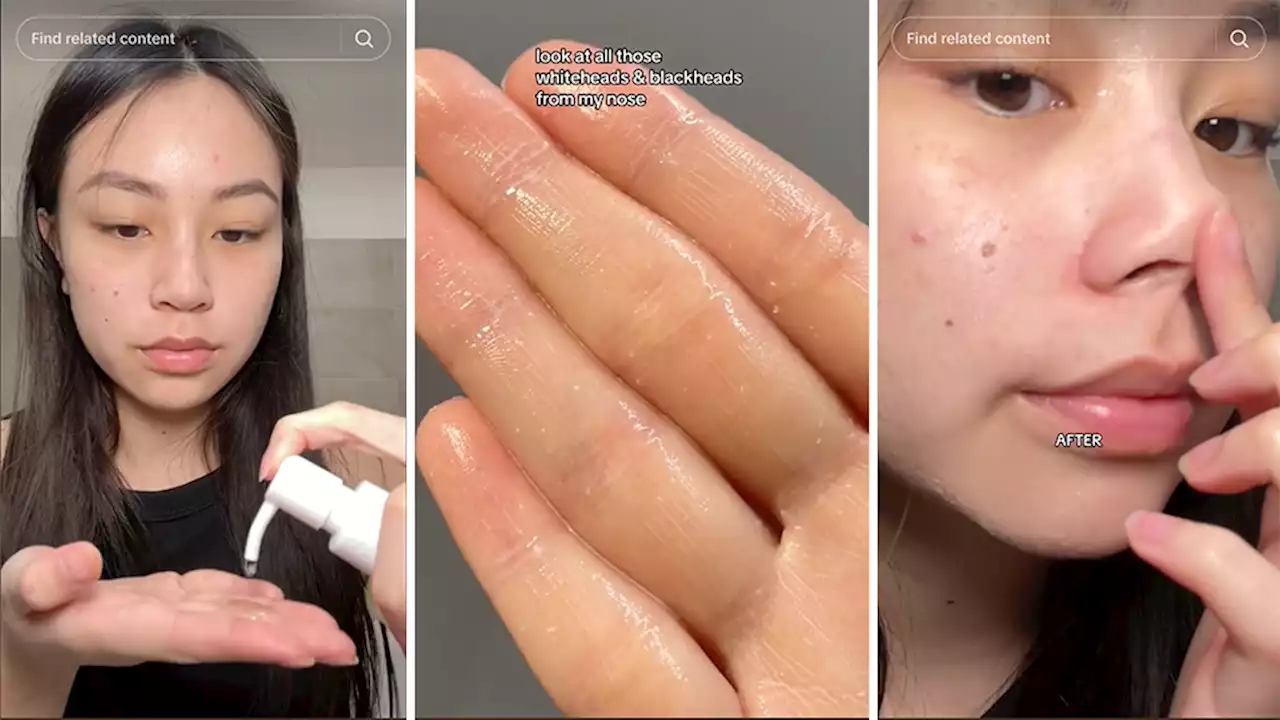 TikTok Is Hooked on This $18 Cleansing Oil That Removes Blackheads on the Spot