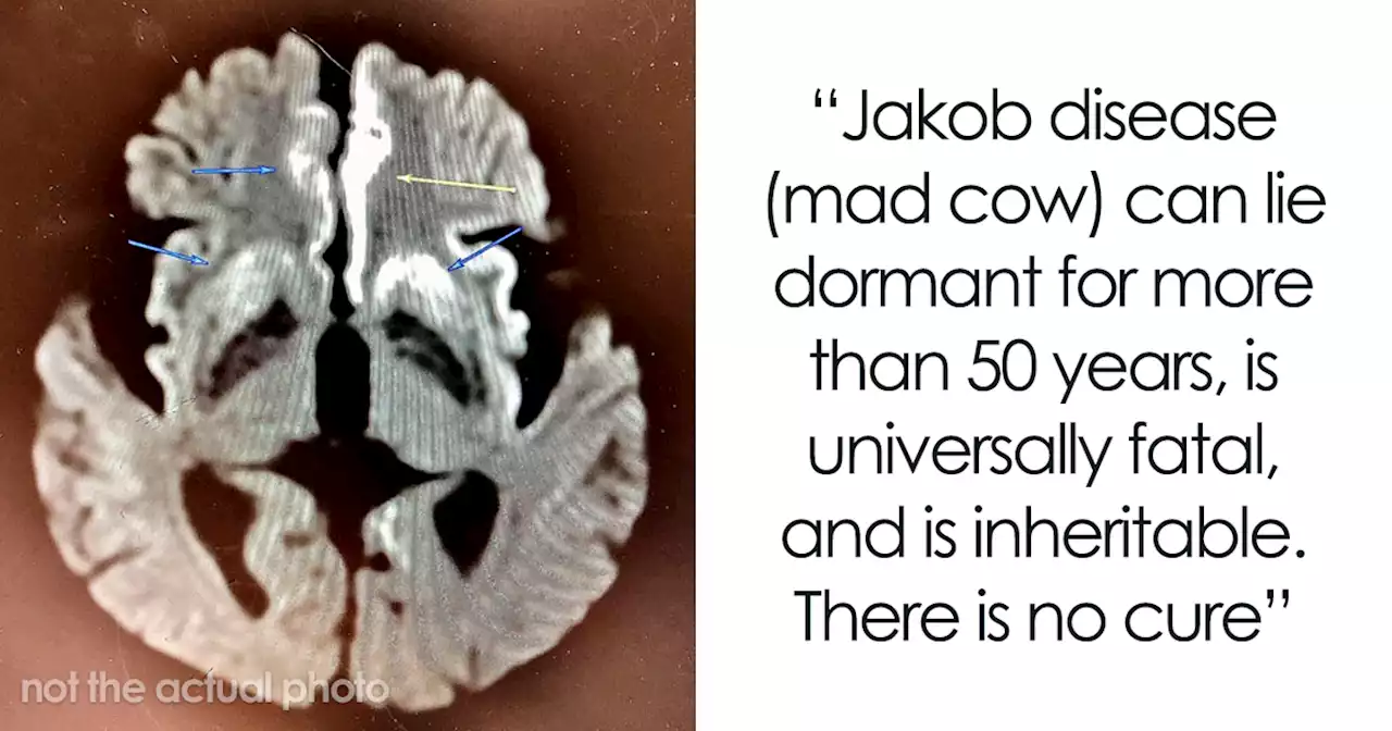 People Share 48 “Genuinely Terrifying” Facts