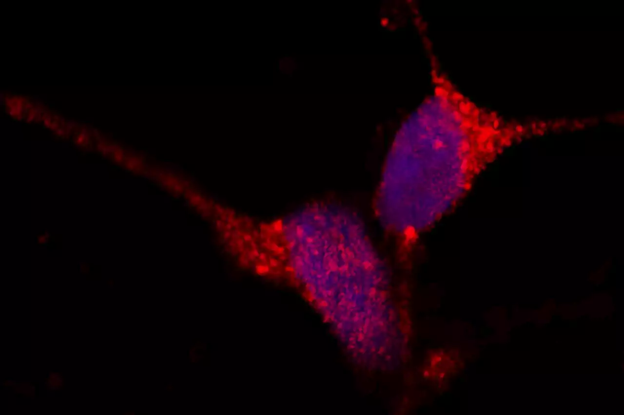 Researchers identify key steps to toxic protein accumulation in Alzheimer's and other diseases