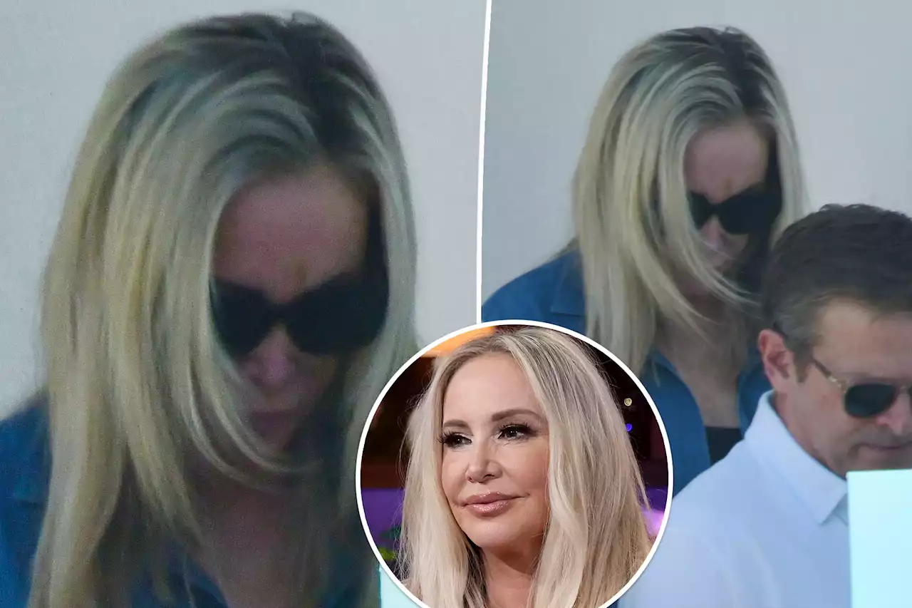 Shannon Beador tries to cover apparent bruise on her face after DUI arrest