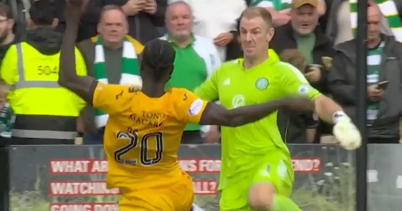 Neil Lennon calls Joe Hart 'reckless' after Celtic red card