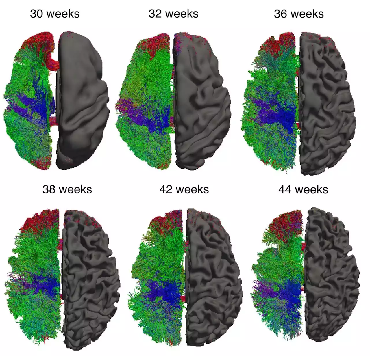 Q&A: How new software is changing our understanding of human brain development