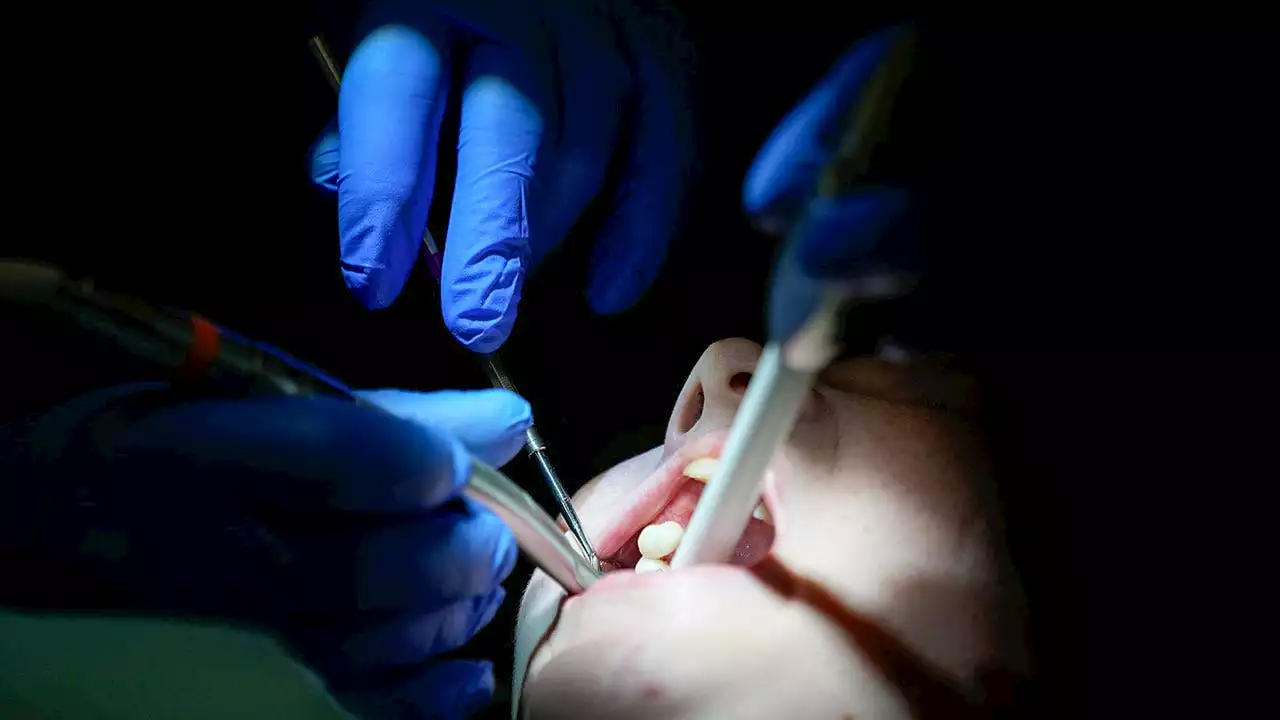 States expand Medicaid programs to provide dental care to low-income adults