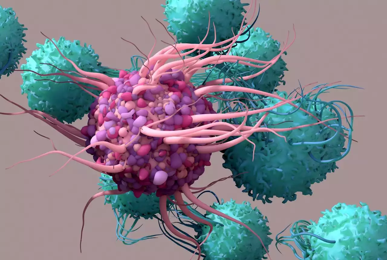 Combination radiation with immunotherapy shows promise against 'cold' breast cancer tumors