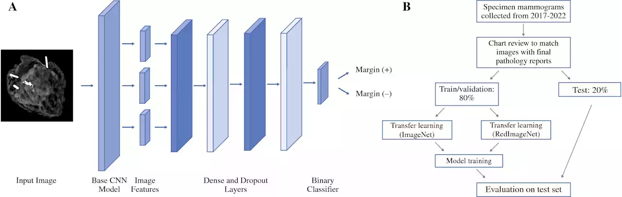 Researchers develop AI model to improve tumor removal accuracy during breast cancer surgery