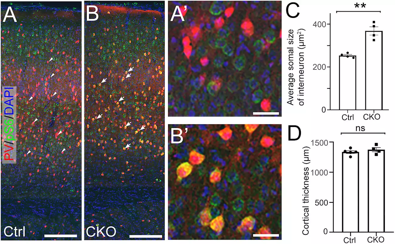 Scientists develop a new model for understanding sudden death in epilepsy