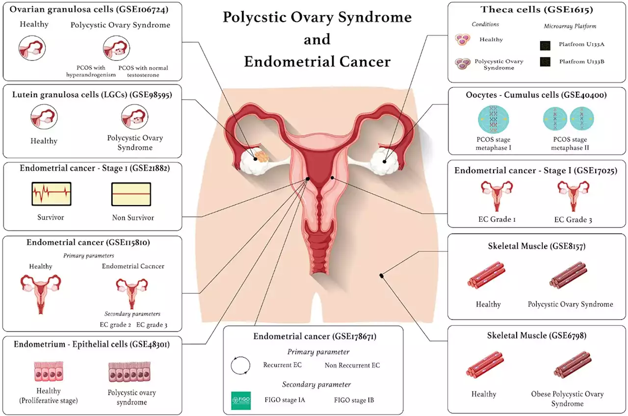 Four novel receptors may link endometrial cancer to PCOS