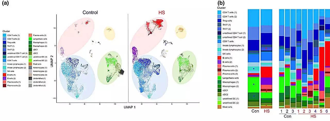 Scientists unearth potential new target for treating debilitating skin disease