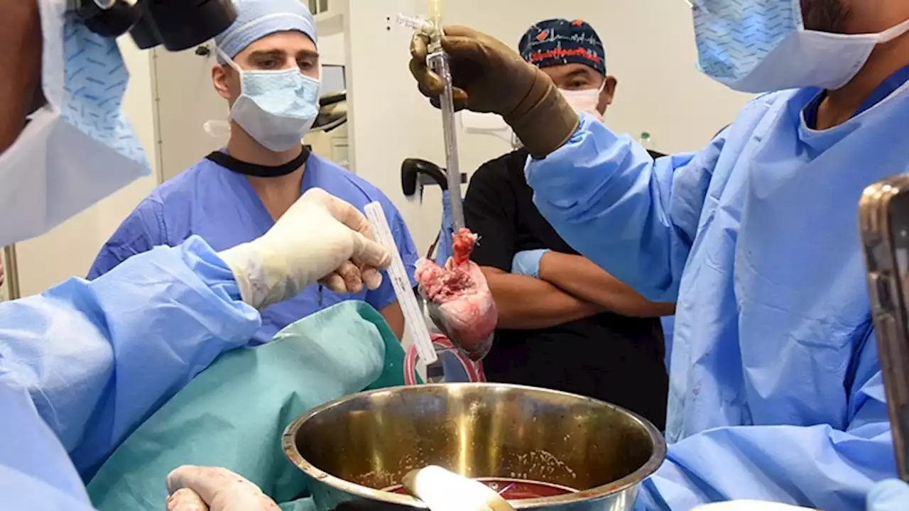 Second Pig-Heart Transplant Patient at UM Faring Well