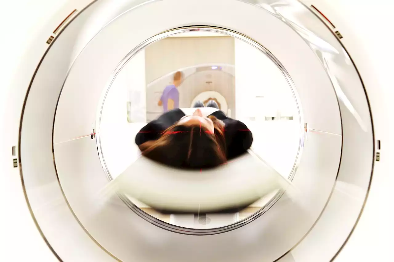 Deep learning revolutionizes ultra-low-field brain MRI for quicker, clearer scans