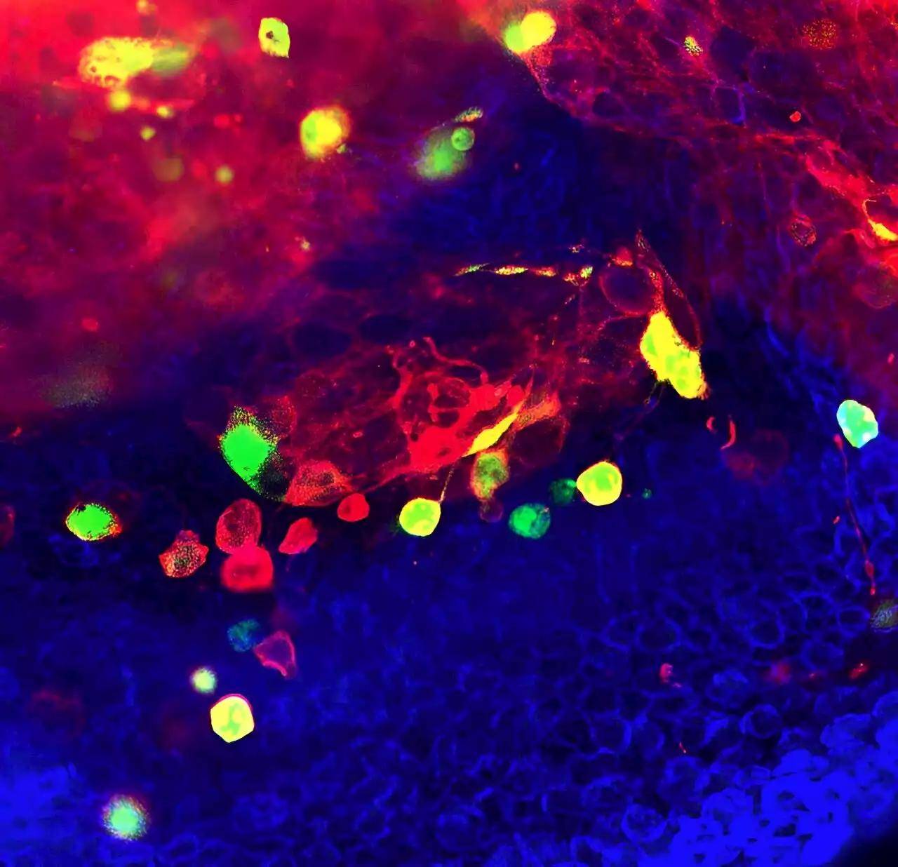 Chromosomal instability in cancer cells causes DNA damage and promotes invasiveness: Study