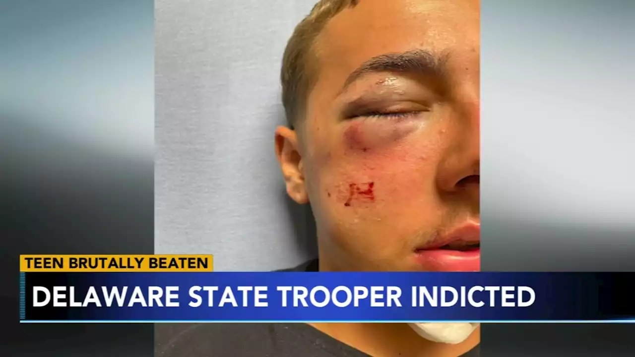 Delaware trooper facing felony charges involving assaults on teens after doorbell prank at his house