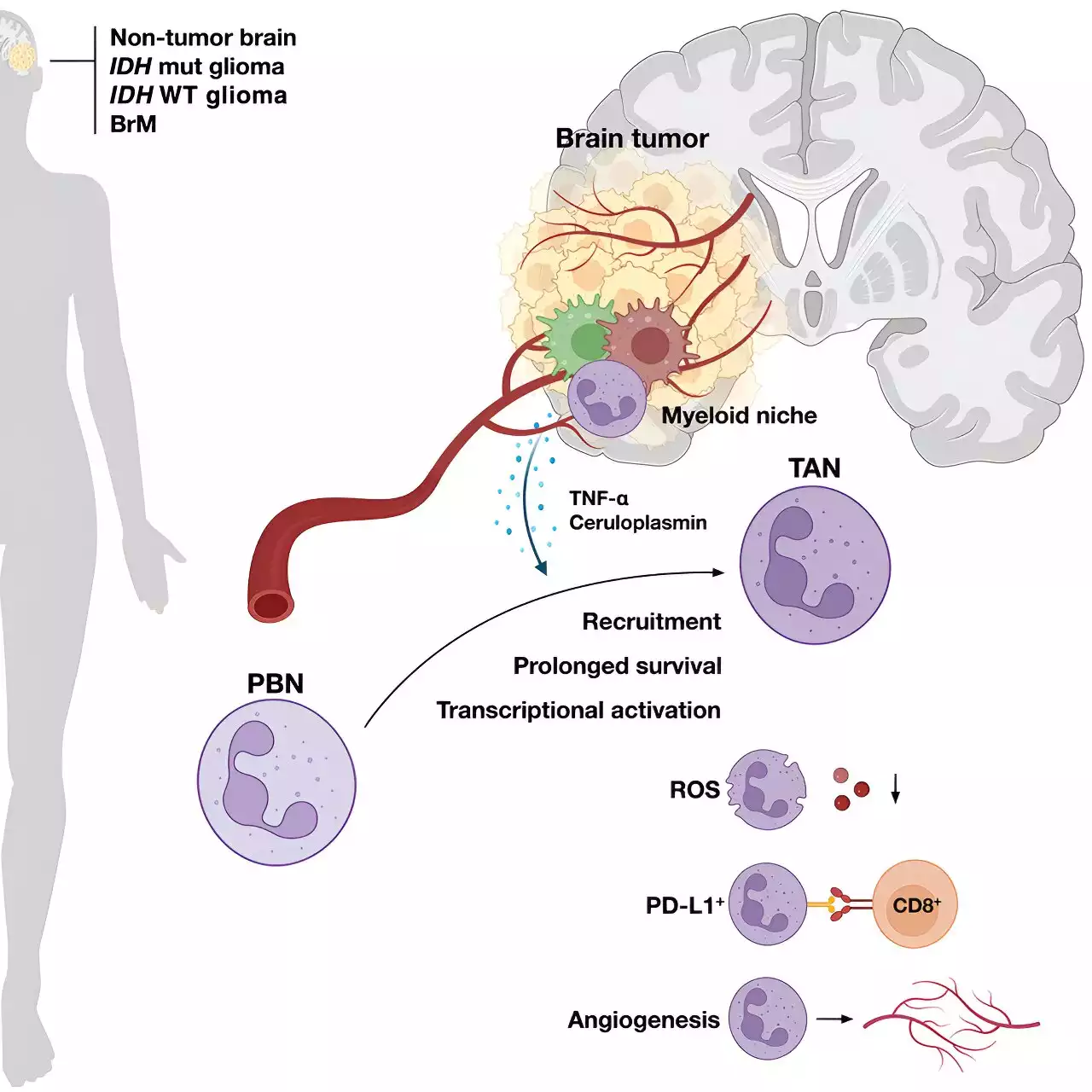 Study shows how brain tumors make certain immune cells turn traitor