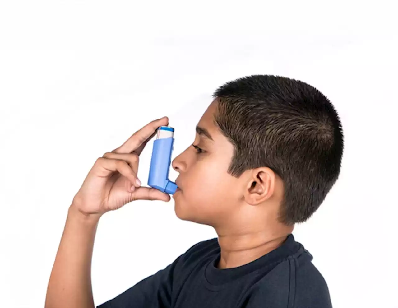 Study finds racial disparities in asthma treatment for children