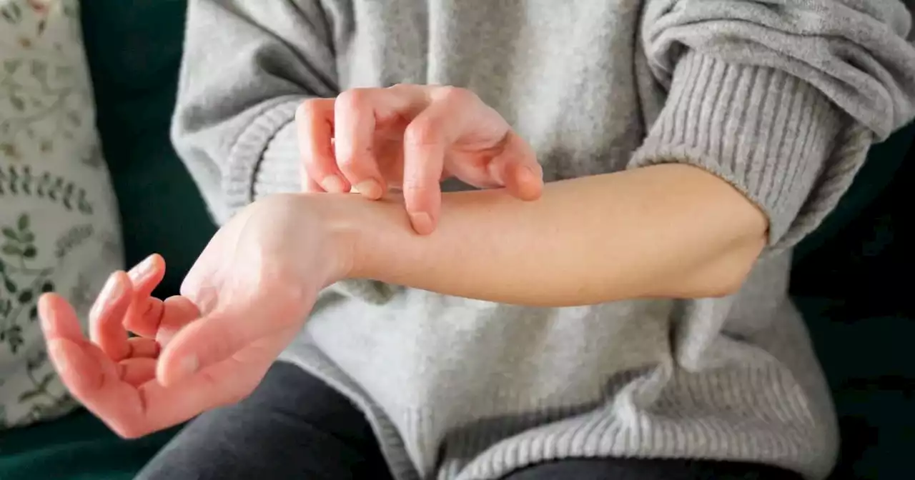 Doctor warns cost of living crisis can trigger itchy skin condition