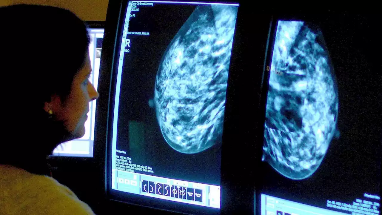 Tens of thousands of UK women dying needlessly from cancer, says report
