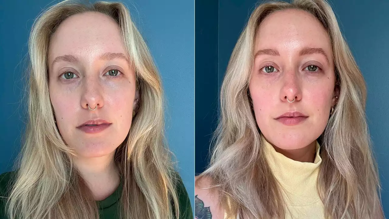 The $68 Brightening Treatment I’m Using to Tackle Sun Spots on My Face