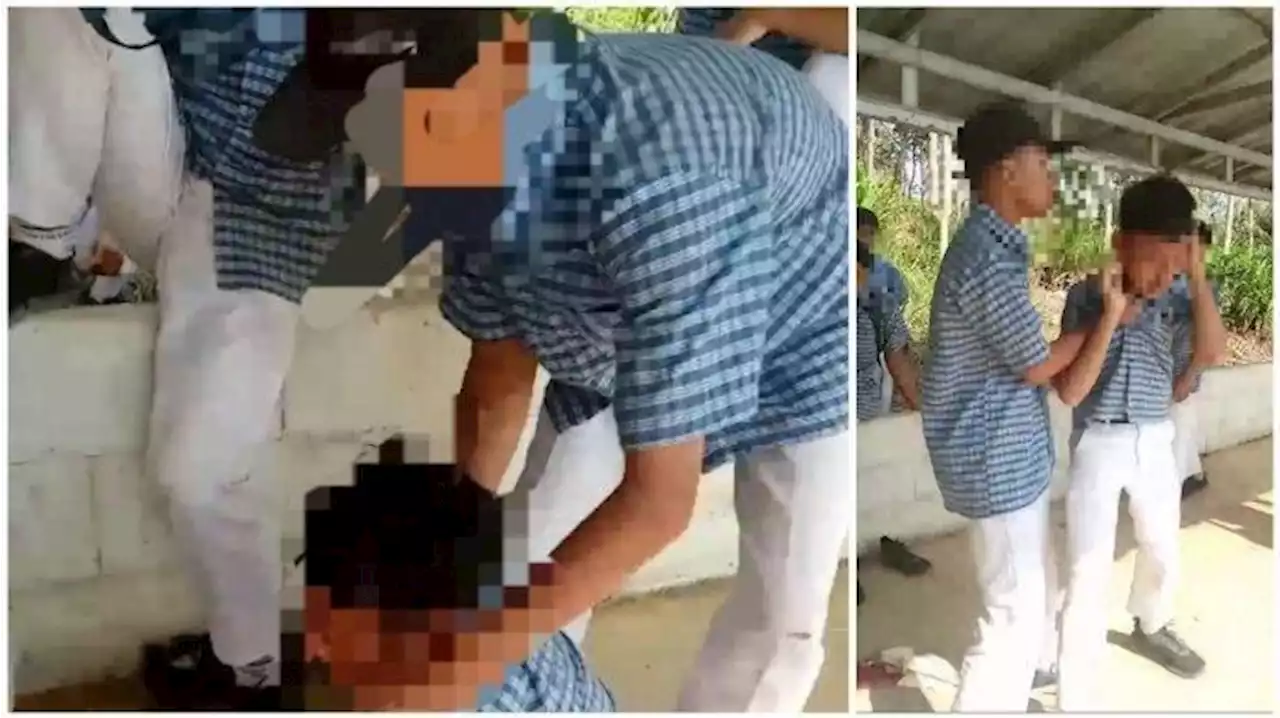 Siswa SMP di Cilacap yang Alami Bullying Kini Dadanya Sesak, Pelaku Terancam 3 Tahun Penjara