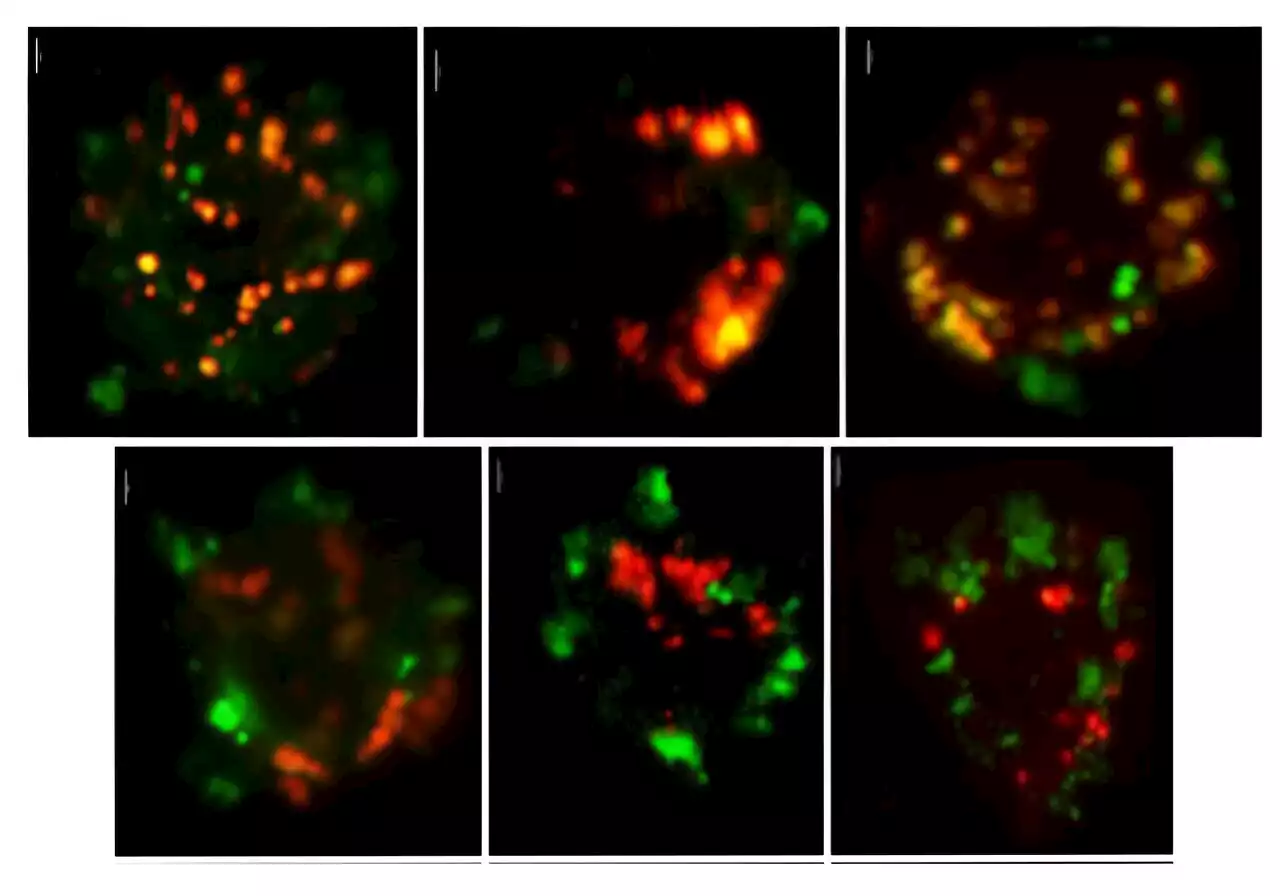 Study identifies new pathway to suppressing autoimmunity