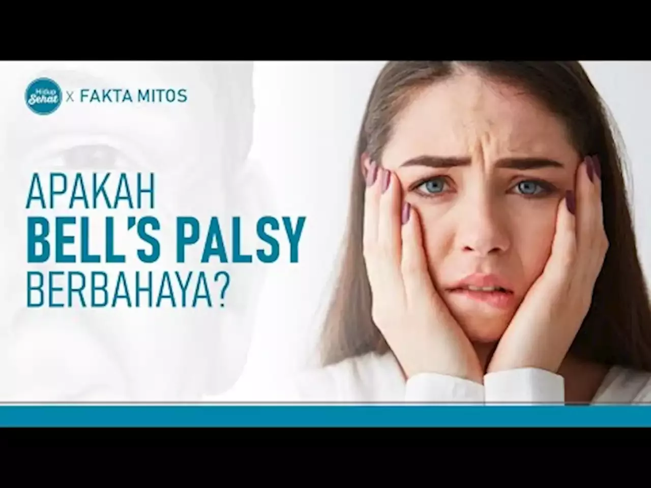 Mirip Gejala Stroke Apakah Bell S Palsy Penyakit Berbahaya