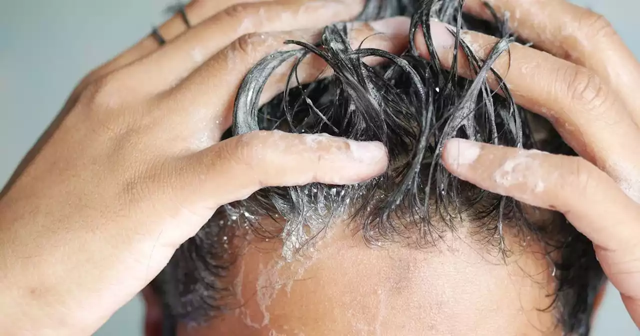 Amazon's £7 'miracle' anti-dandruff shampoo that 'works on dyed hair'