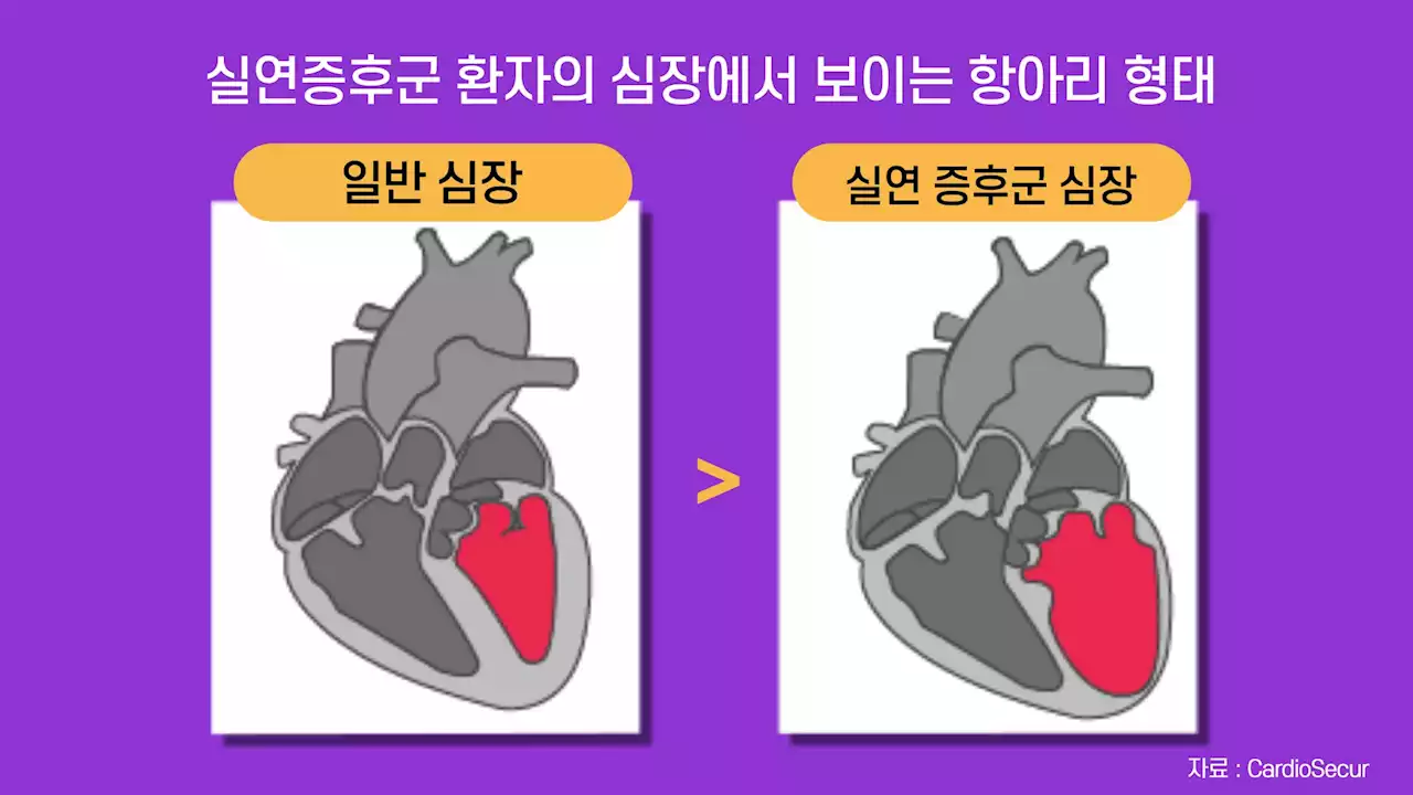 프랑스가 월드컵 우승한 날…심근경색 사망 ‘충격적 반전’