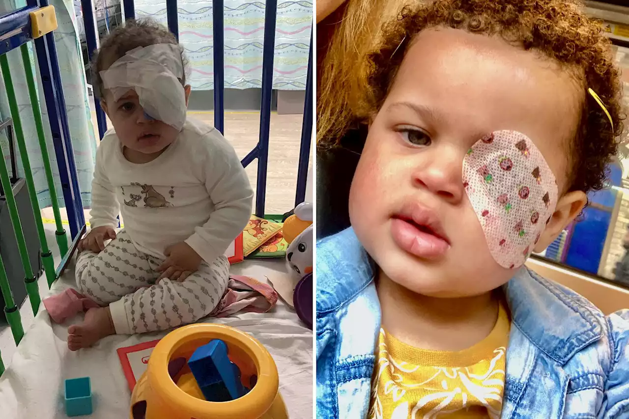 Doctors misdiagnosed my baby’s cancer as eczema — she lost her eye