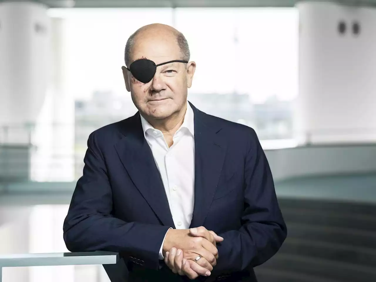 German Chancellor releases photo of himself with black eye patch after jogging accident