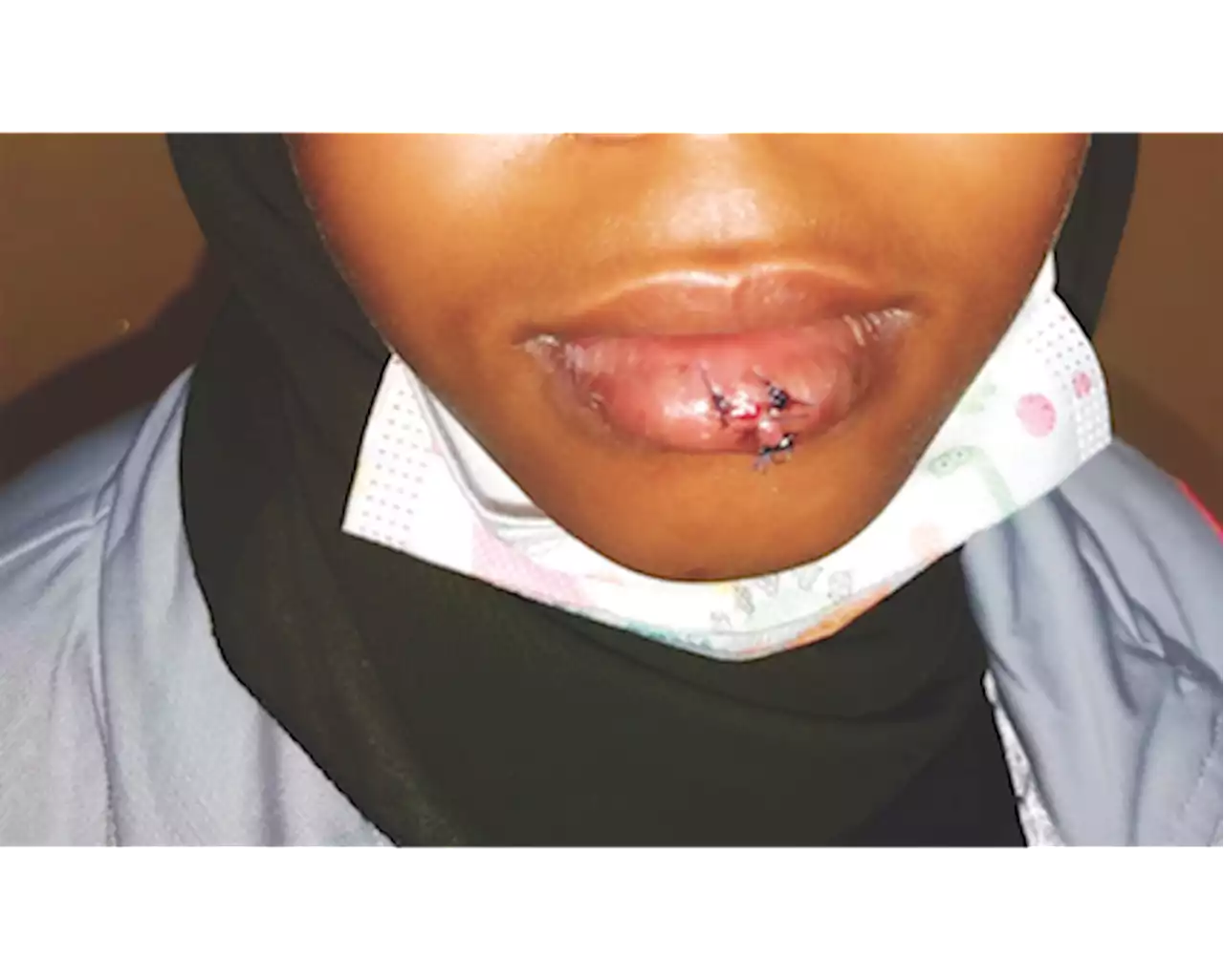 Durban girl assaulted at school: No consequences for alleged bully - LNN