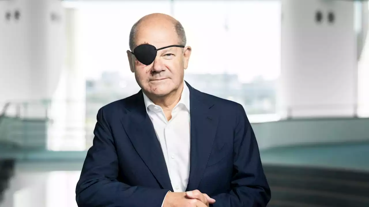 'Excited to see the memes': German Chancellor Scholz tweets picture of himself with eye patch after injury