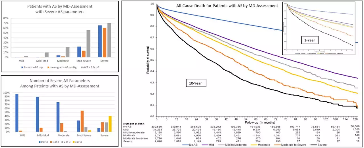 Large study could lead to better management for patients with aortic stenosis