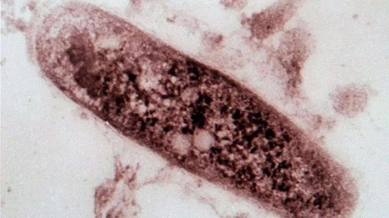 'Extremely concerning' tuberculosis outbreak in far north South Australia prompts testing blitz