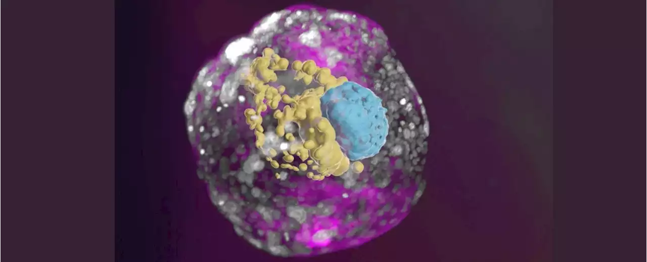 Complete 2-Week Old Human Embryo Models Grown in The Lab For The First Time