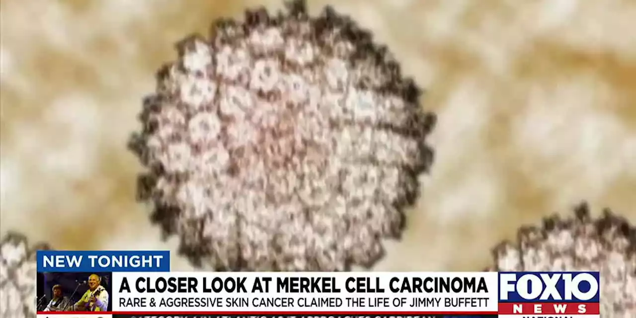 Closer look at Merkel Cell Carcinoma with USA Mitchell Cancer Institute