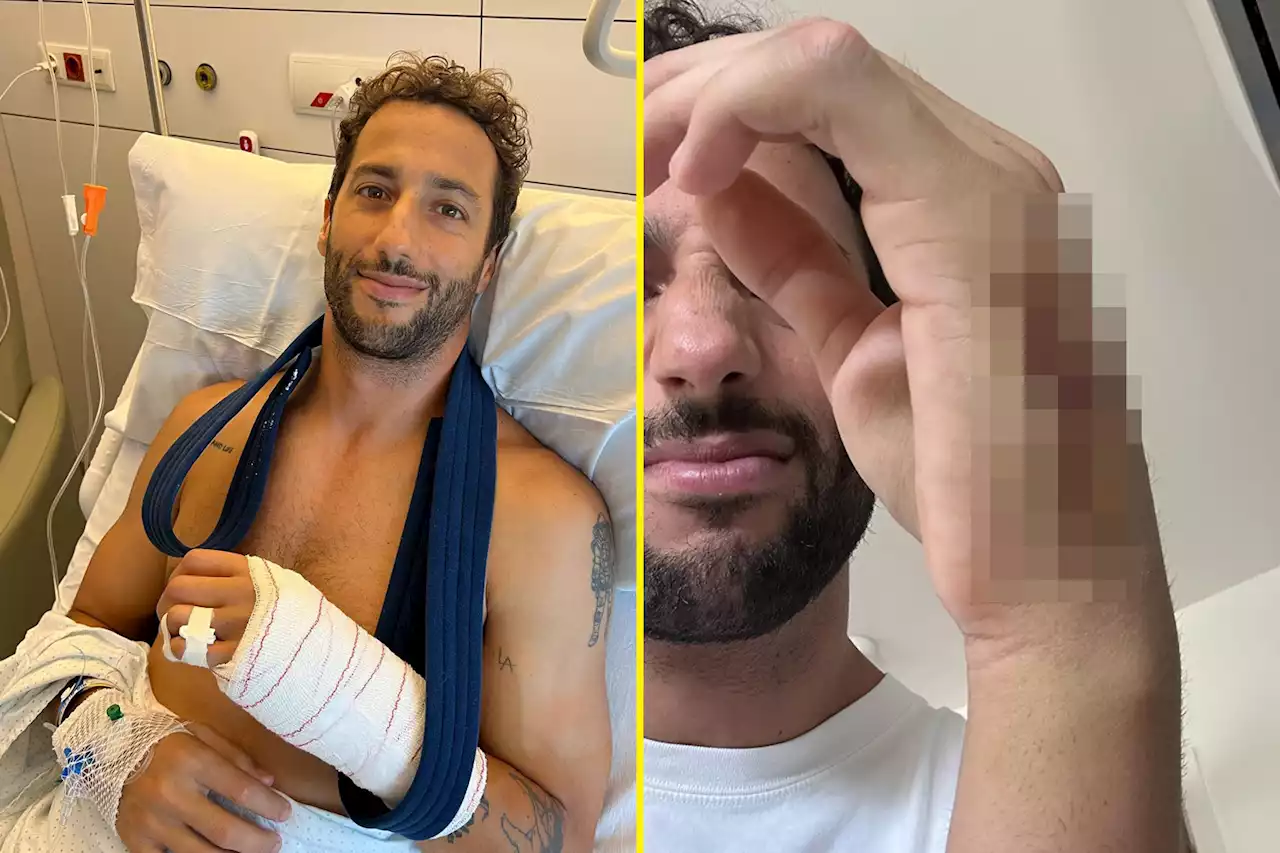 Daniel Ricciardo shares gruesome hand surgery scar as Formula 1 star steps up rehab