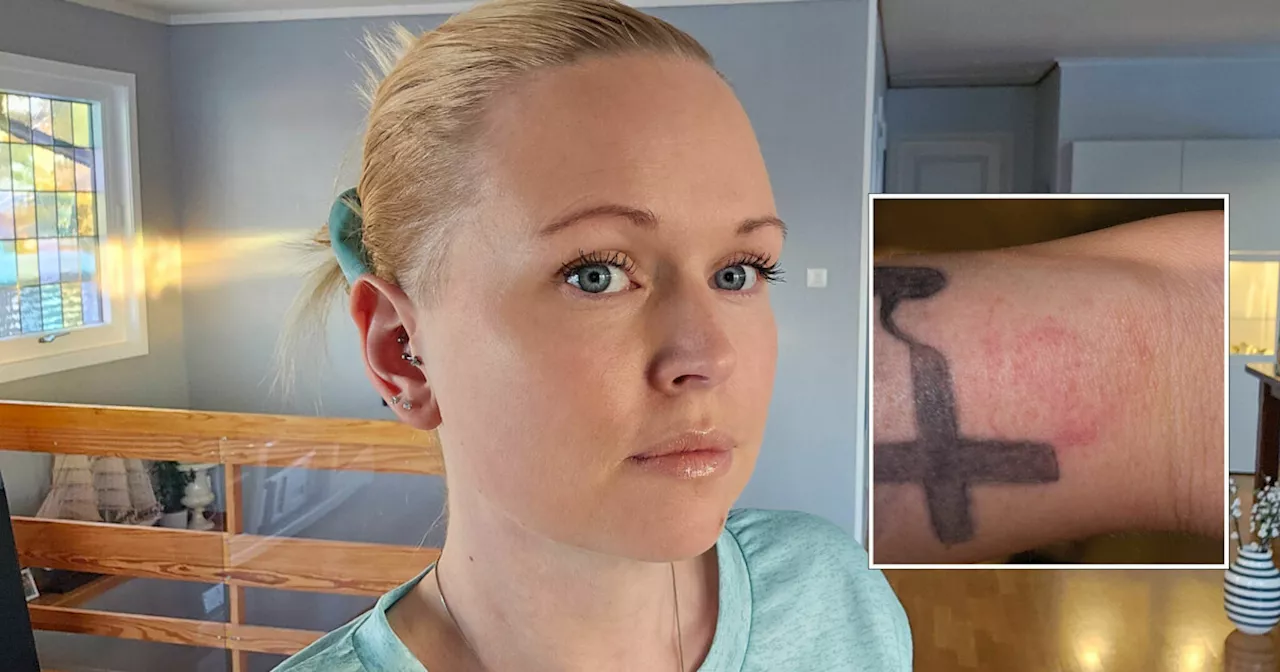 Reagerte på smartklokke fra Fitbit: - Det var vondt