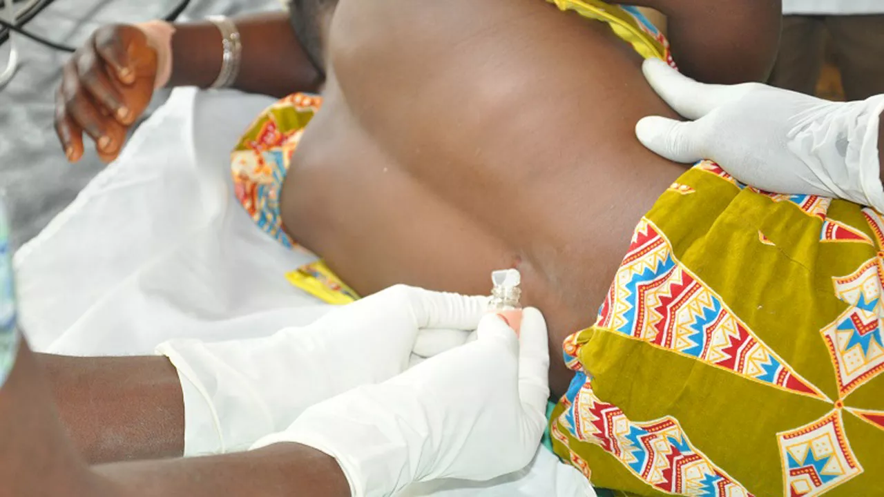 Nigeria Centre for Disease Prevention and Control issues advisory on Cerebrospinal Meningitis outbreak
