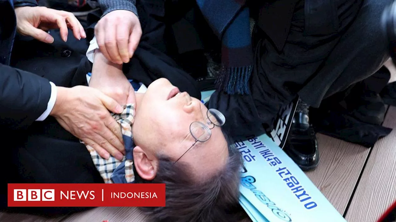 Korsel: Pemimpin oposisi Lee Jae-Myung ditikam, tambah panjang daftar serangan terhadap politisi Korea Selatan