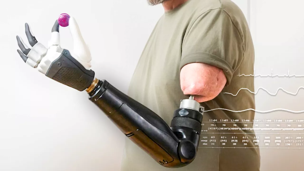 Regaining Sensation: A Breakthrough in Bionic Prosthetics